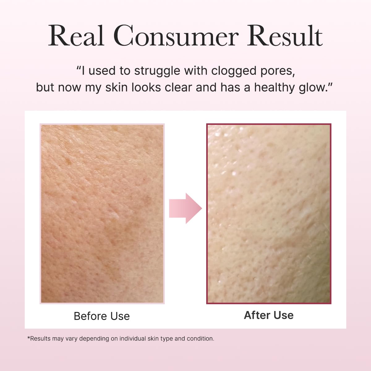 FRESH ROSEHIP RICE MOCHI CLEANSER 120G