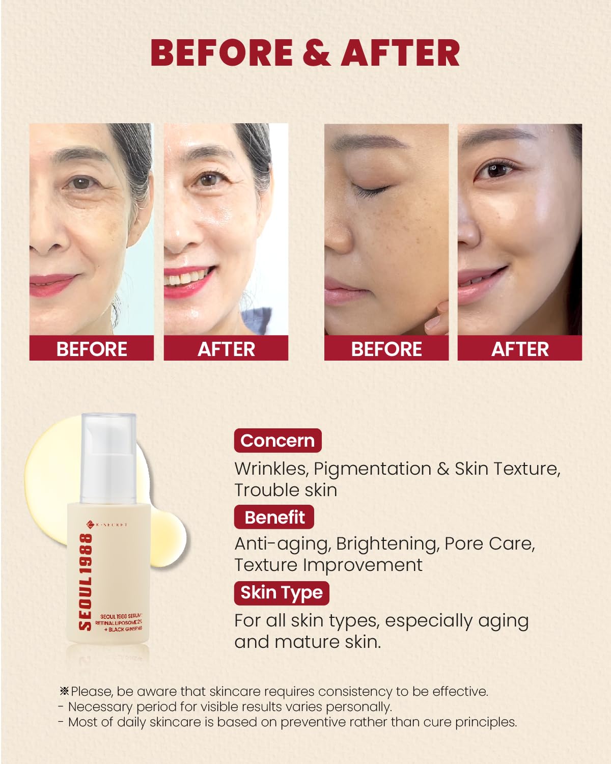 SEOUL 1988 RE SERUM 30ML