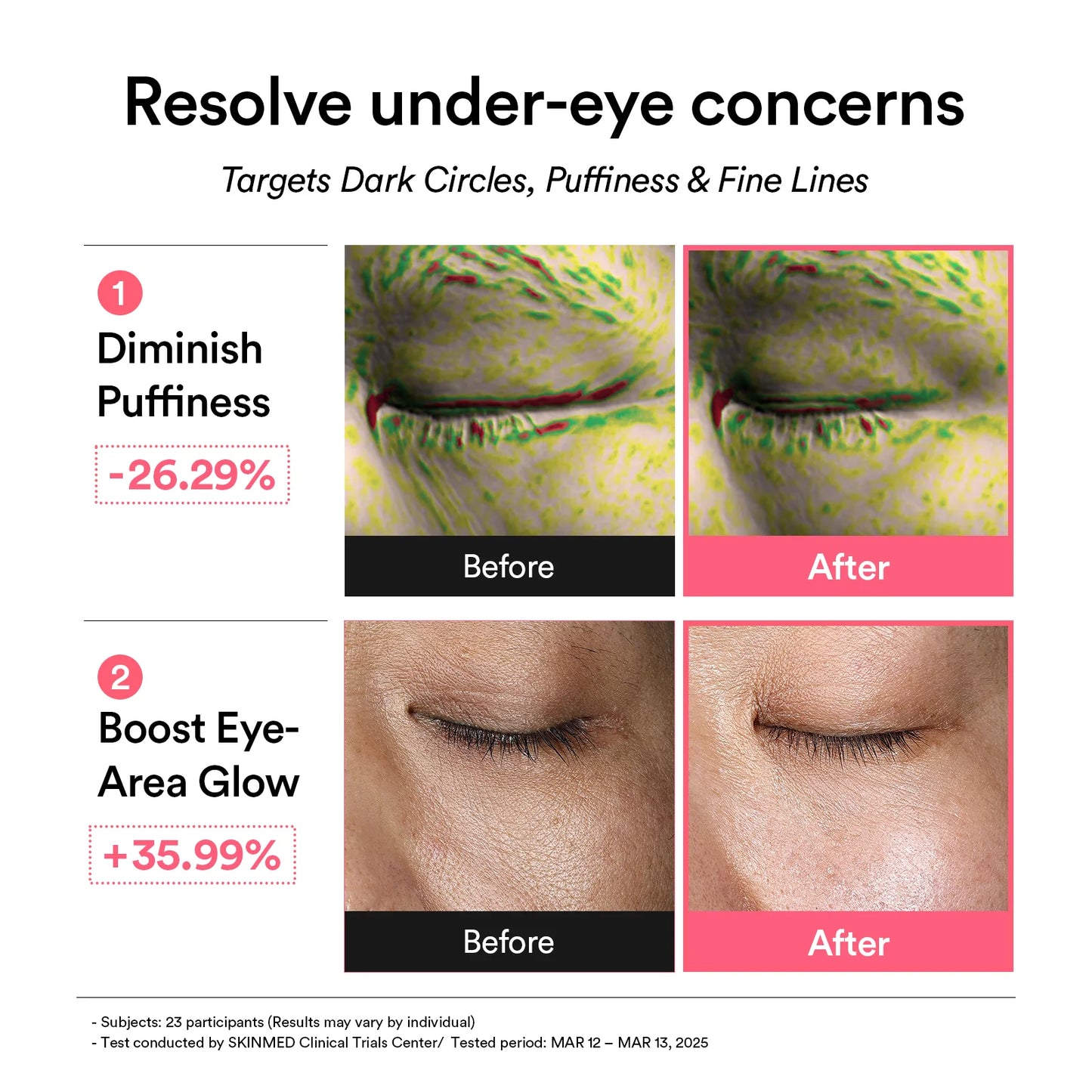 PDRN RETINAL EYE PATCH GLOW JELLY (60EA) 84G
