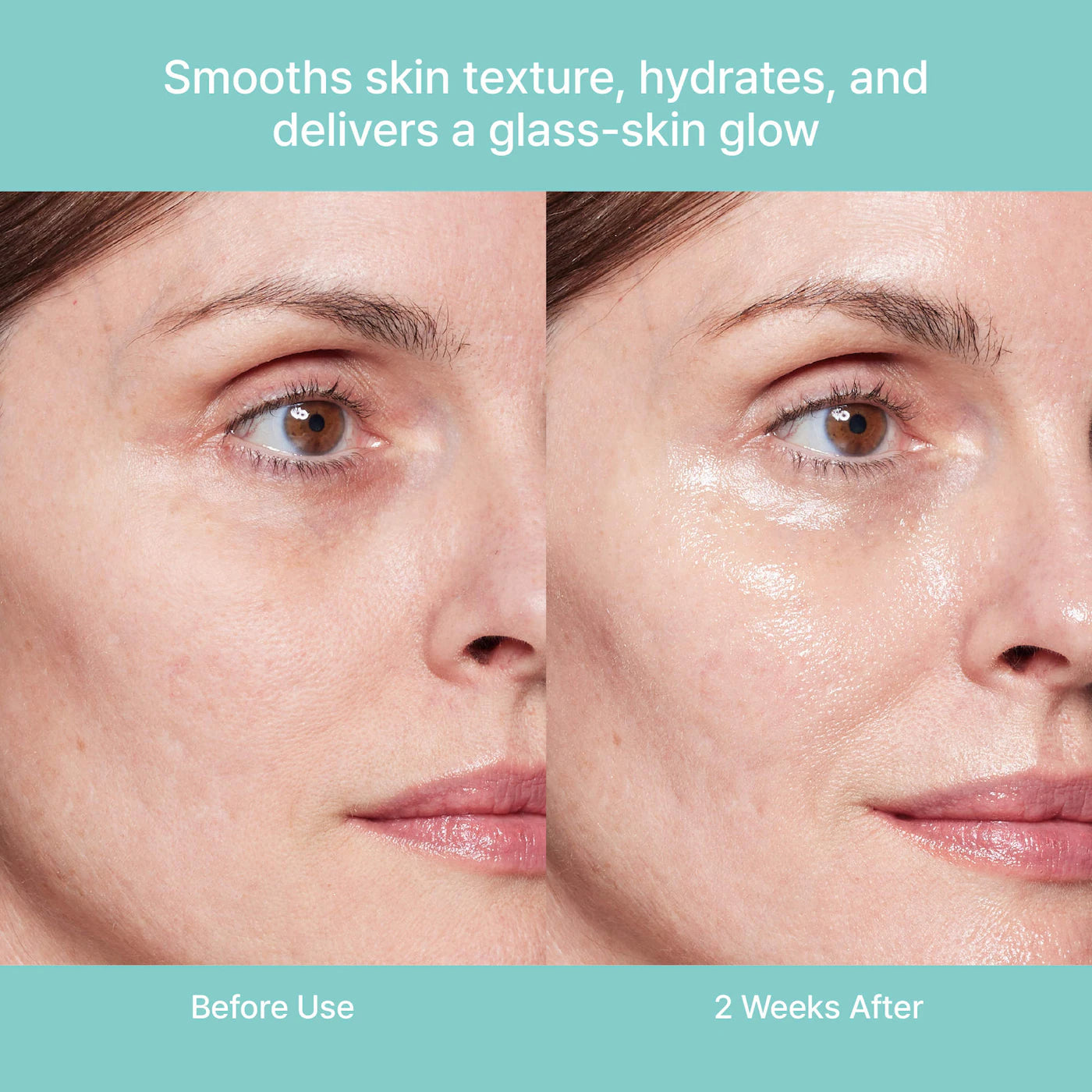 Rejuran Turnover Ampoule c-PDRN 0.5% *limited quantities*